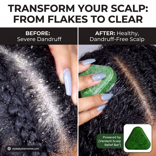 ScalpRevive™ – Hair Growth & Anti-dandruff Soap